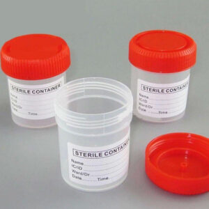 Urine Culture Container